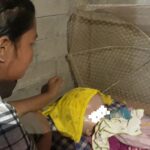 Bayi Pengidap Hydrocephalus di Sausu Tambu Parimo Butuh Bantuan