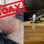 IMIP Tegaskan Cacar Monyet Ditemukan di Kawasannya Adalah Hoaks