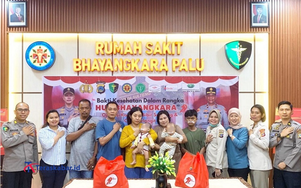 HUT Bhayangkara Ke-79, Polda Sulteng Kembali Gelar Baktikes, Operasi Bibir Sumbing dan Katarak