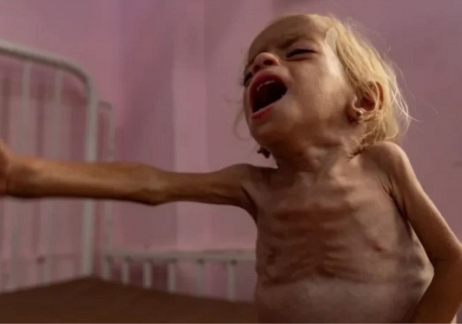 Korban Tewas Kelaparan Paksa di Gaza Tembus 300 Orang, 132.000 Balita Terancam Meninggal Dunia