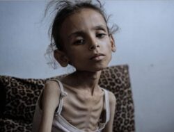Tujuh Warga Gaza Tewas karena Kelaparan dan Malnutrisi, Total Korban Jadi 169 Orang