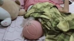 Korban Tronton di Morut Diamputasi 2 Kali, Pemilik Ingkar Janji
