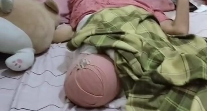 Korban Tronton di Morut Diamputasi 2 Kali, Pemilik Ingkar Janji
