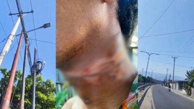 Dua Warga Palu Terlilit Kabel Provider Internet, Leher Nyaris Putus